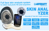 12 Million Pixel-tragbarer Haut-Analyse-Hautpflege-Analysator 32G
