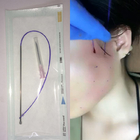PDO-Faden-Hyaluronsäure-Hautfüller-nicht chirurgischer Faden-Aufzug 30g 29g 25mm